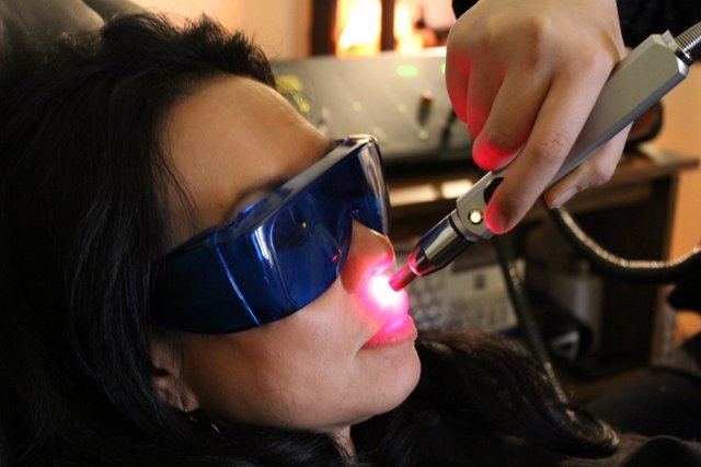 Image result for laser therapy for smoking